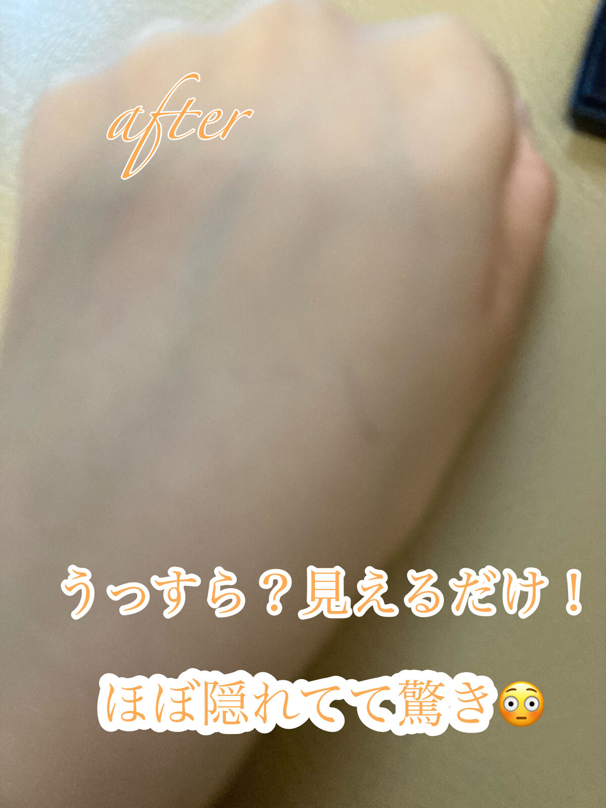 フローレス フィット FR10/COVERMARK/クリーム・エマルジョンファンデーションを使ったクチコミ（3枚目）