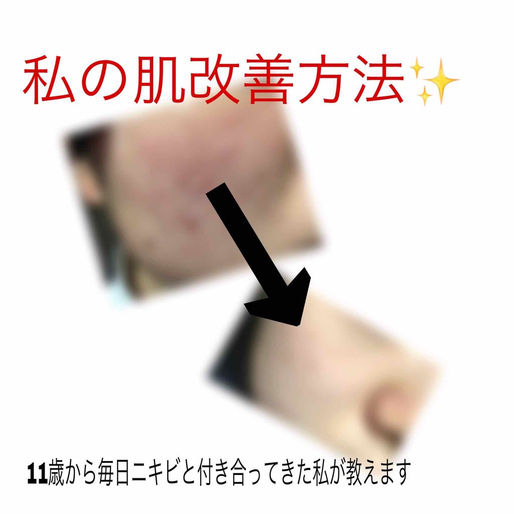 ハトムギ化粧水(ナチュリエ スキンコンディショナー R )/ナチュリエ/化粧水を使ったクチコミ(1枚目)