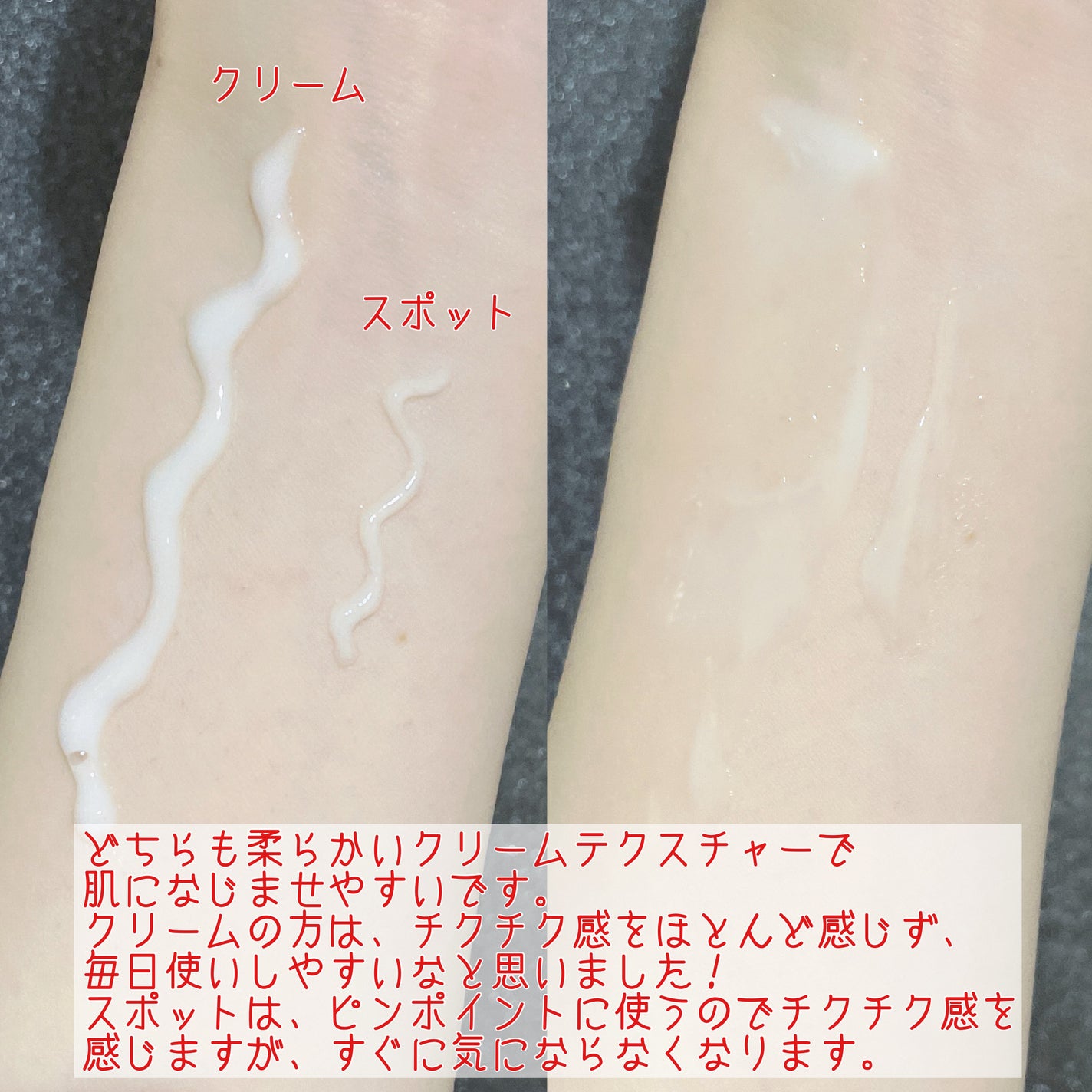 エーキュアスピキュールスポット/obsero/フェイスクリームを使ったクチコミ(6枚目)
