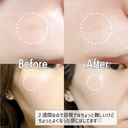 リードルショット300/VT/美容液を使ったクチコミ(6枚目)