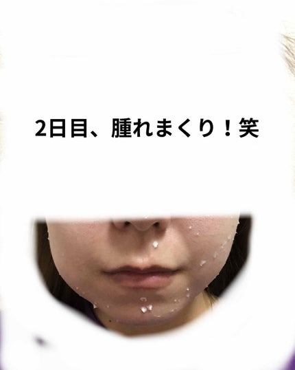 ニョッキ on LIPS 「私は幼少期からずーーっとコンプレックスを持っていた事がありまし..」(4枚目)