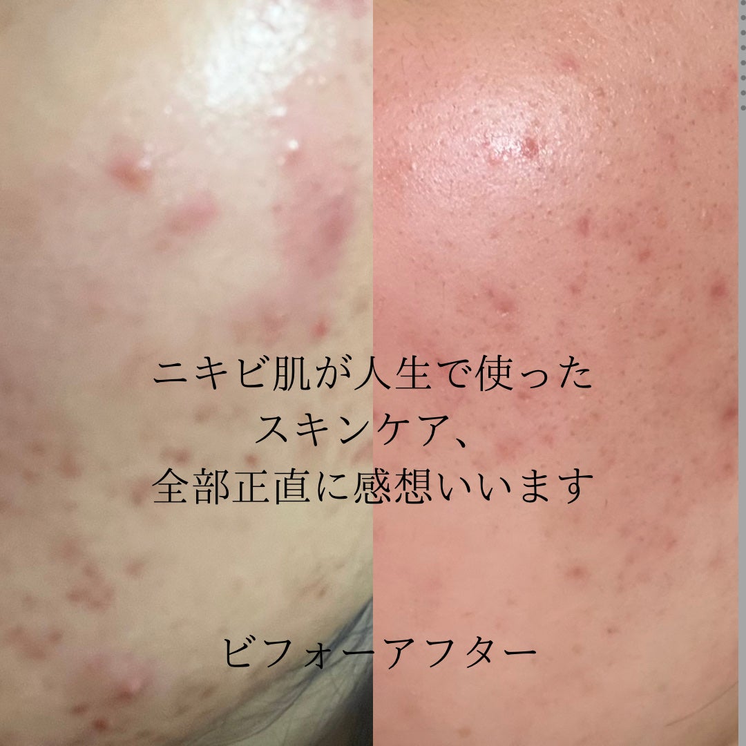 DHC 薬用ディープクレンジングオイル/DHC/オイルクレンジングを使ったクチコミ(2枚目)