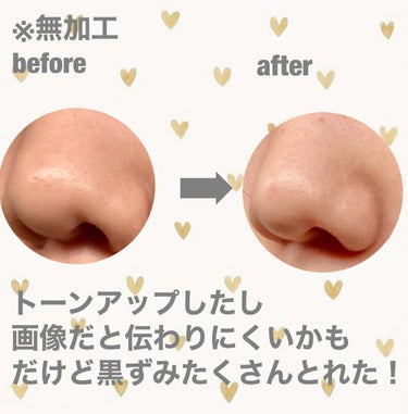 ツルリ ツルリ 皮脂吸い出し 部分用パック ガスール＆レッドパワーのクチコミ「黒ずみ撃退アイテム
泥パックなんだけど黒ずみがつるんと落ちる
使った後は乾燥するから絶対に保湿.....」（2枚目）