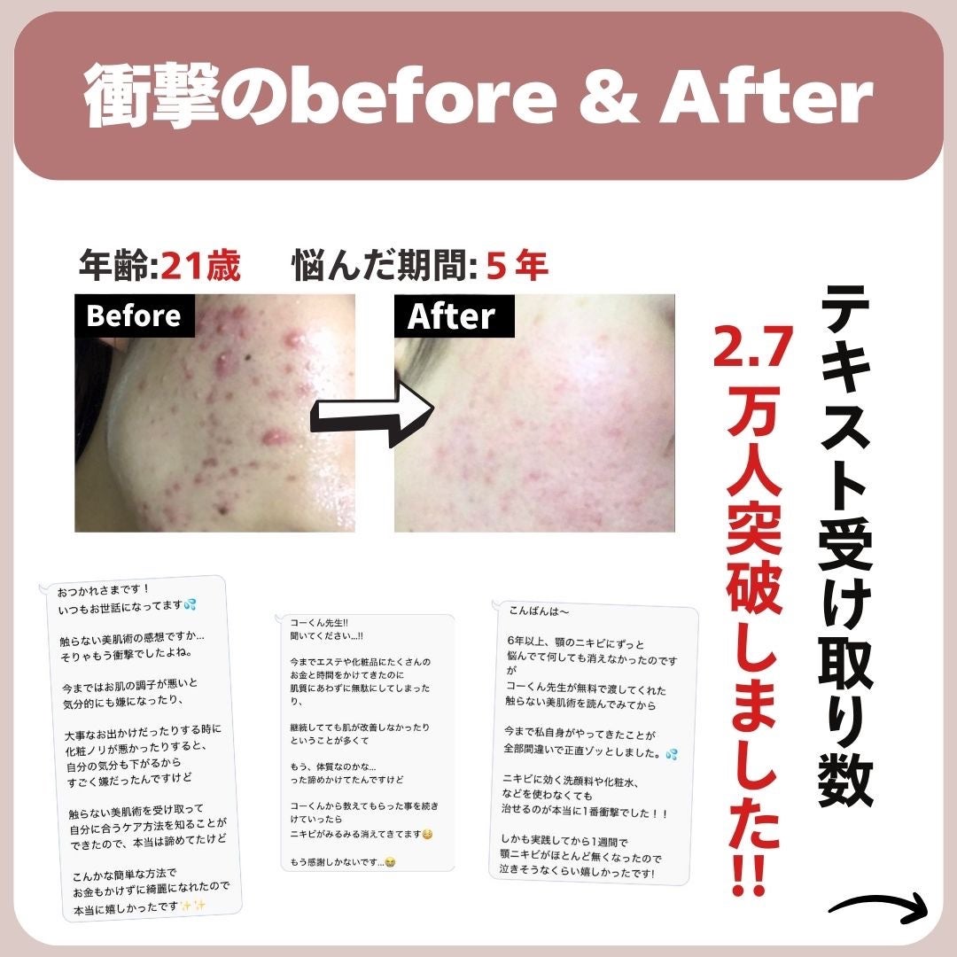 あなたの肌に合ったスキンケア💐コーくん先生 on LIPS 「【9割が知らない】透明感爆誕する神スキンケア...あなたの毛穴..」(8枚目)