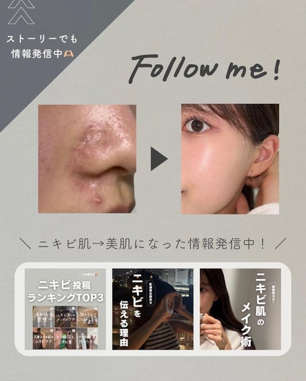 白湯(サユ) | ニキビと戦うOL🤍 on LIPS 「いよいよこの企画が始動🫣!!私もめちゃくちゃ楽しみにしてたフ..」(10枚目)