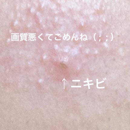 ティーツリーカーミングスポットパッチ/MEDIHEAL/その他スキンケアを使ったクチコミ(3枚目)