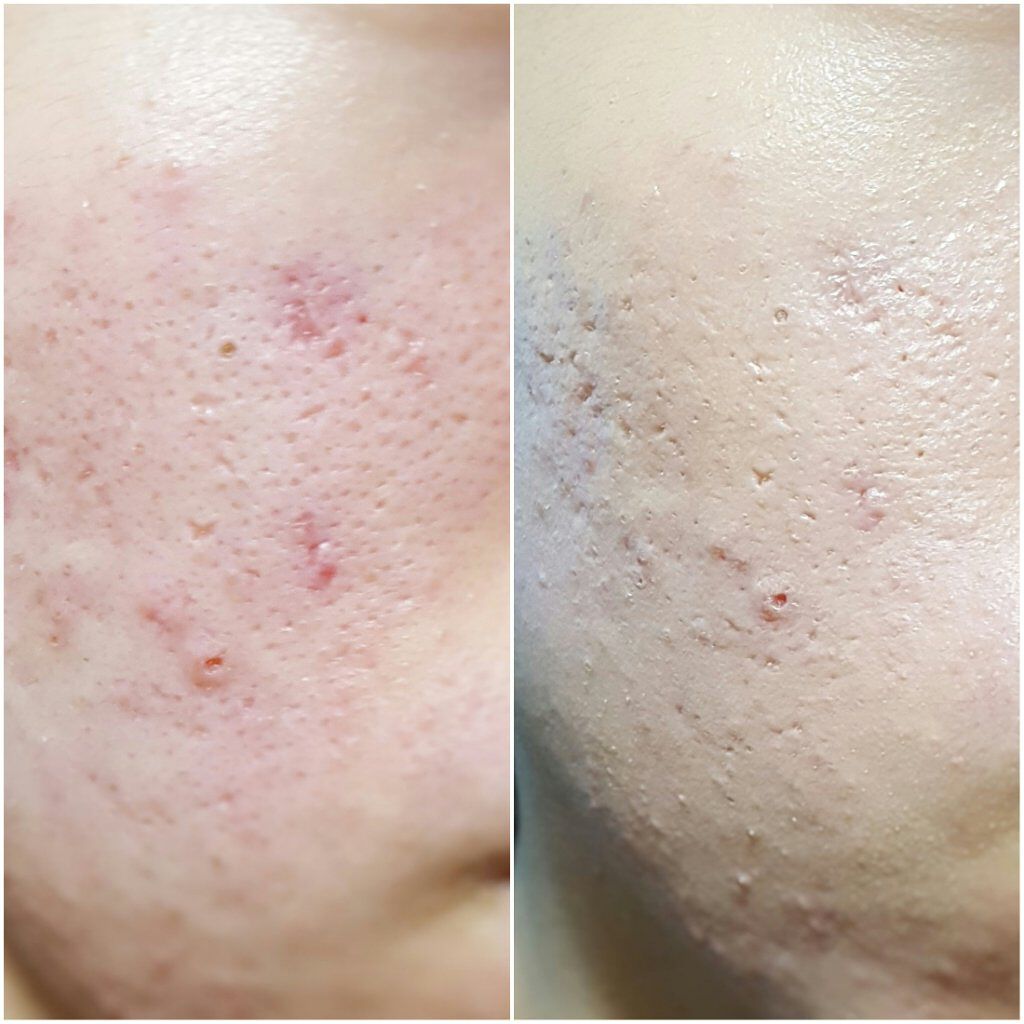 モイスチャーライズ カバー クッション/Witch's Pouch/クッションファンデーションを使ったクチコミ(4枚目)