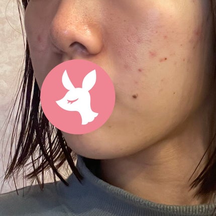 キールズ ハーバル トナー CL アルコールフリー/Kiehl's/化粧水を使ったクチコミ(2枚目)