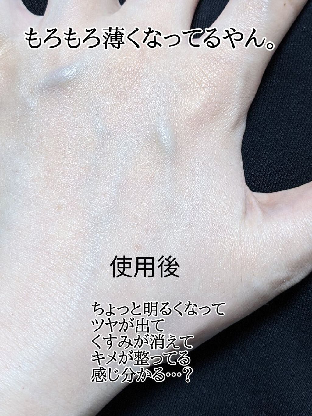 ボタニック サイエンス 薬用 美容液クッションコンパクト/HAKU/クッションファンデーションを使ったクチコミ(3枚目)