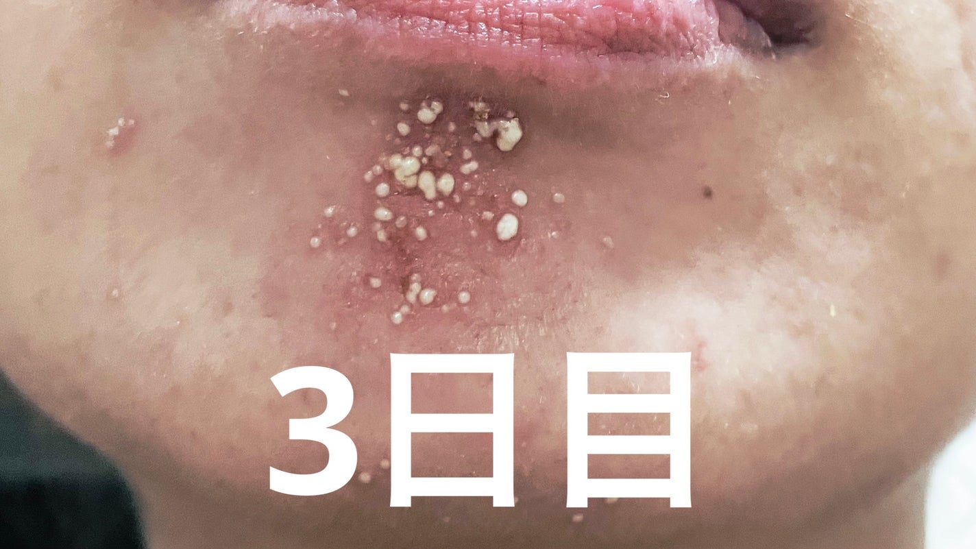 ソフティモ 泡洗顔(セラミド)/ソフティモ/泡洗顔を使ったクチコミ(4枚目)