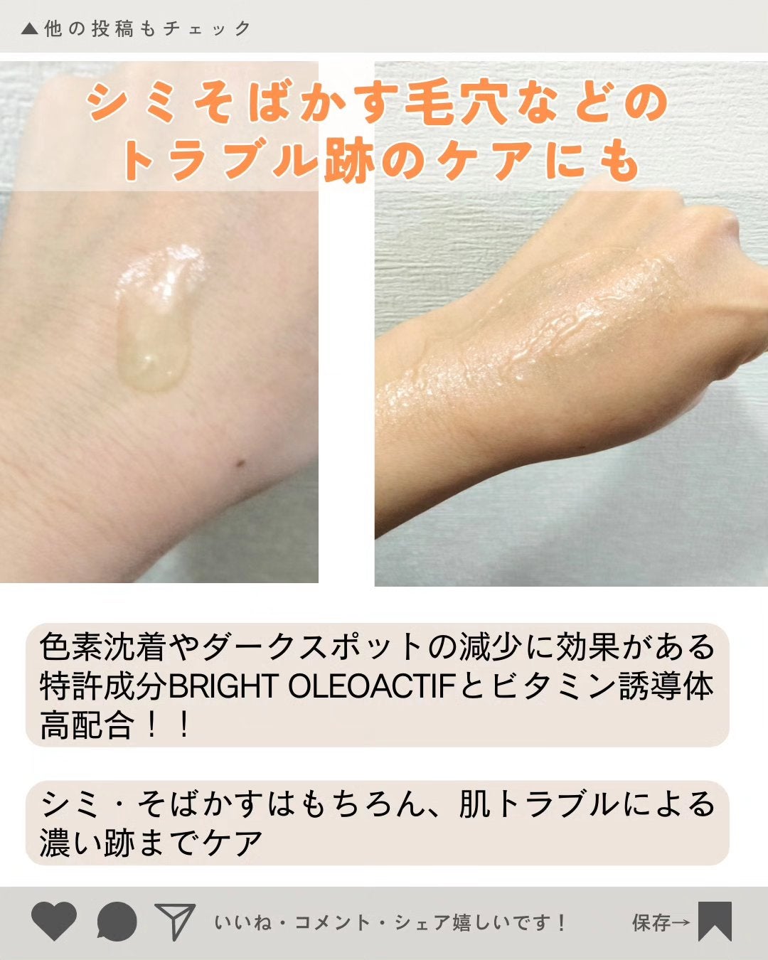 ユズナイアシンアンチブレミッシュセラム/SOME BY MI/美容液を使ったクチコミ(3枚目)