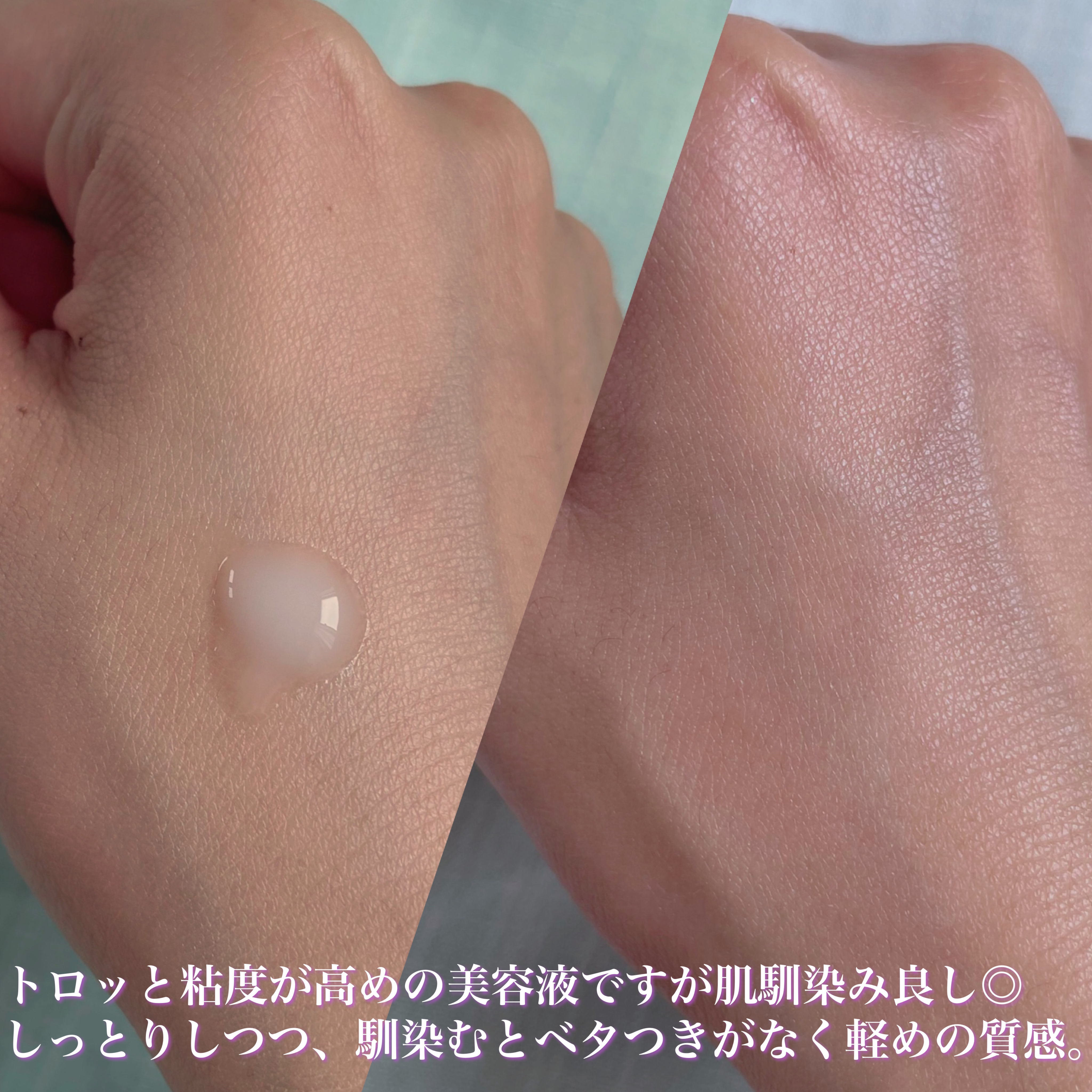 エクソバイオームアンプル/DR.PEPTI/美容液を使ったクチコミ（3枚目）