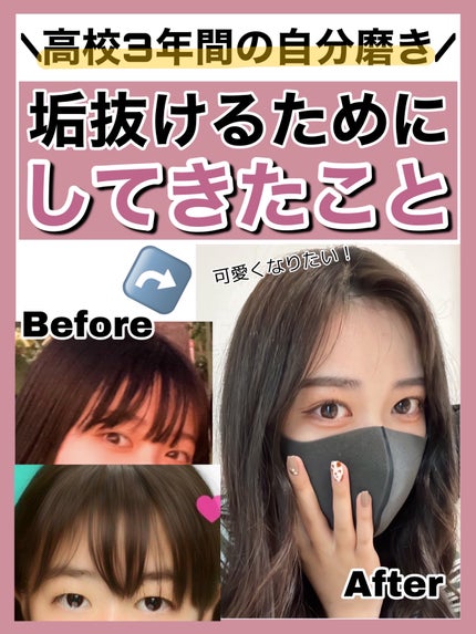 脱色クリーム 敏感肌用/エピラット/ムダ毛ケアを使ったクチコミ(1枚目)