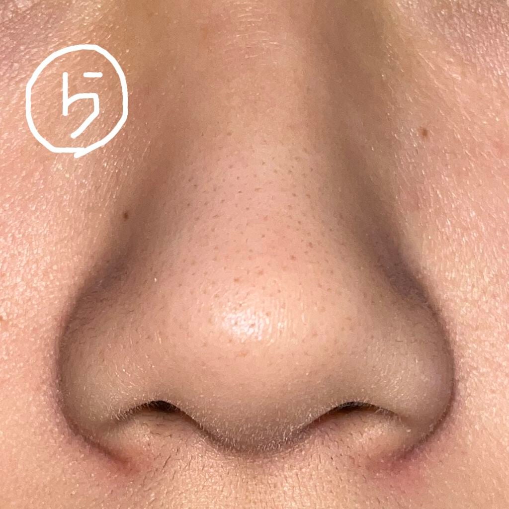 DETクリア ブライト&ピール ピーリングジェリー <ミックスベリーの香り>/Detclear/ピーリングを使ったクチコミ(6枚目)