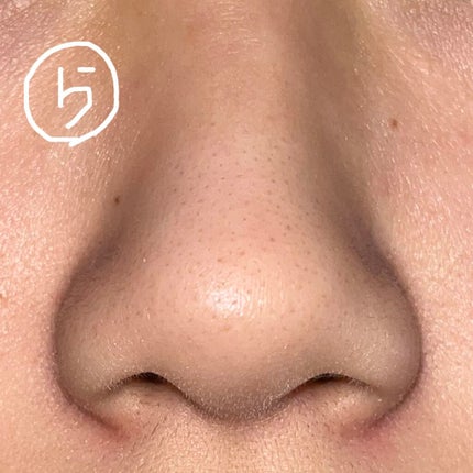 DETクリア ブライト&ピール ピーリングジェリー <ミックスベリーの香り>/Detclear/ピーリングを使ったクチコミ(6枚目)