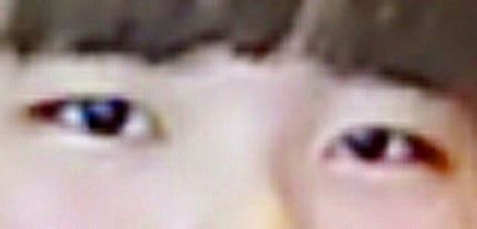 アイビューティー フィクサー WP/アストレア ヴィルゴ/二重まぶた用アイテムを使ったクチコミ(2枚目)