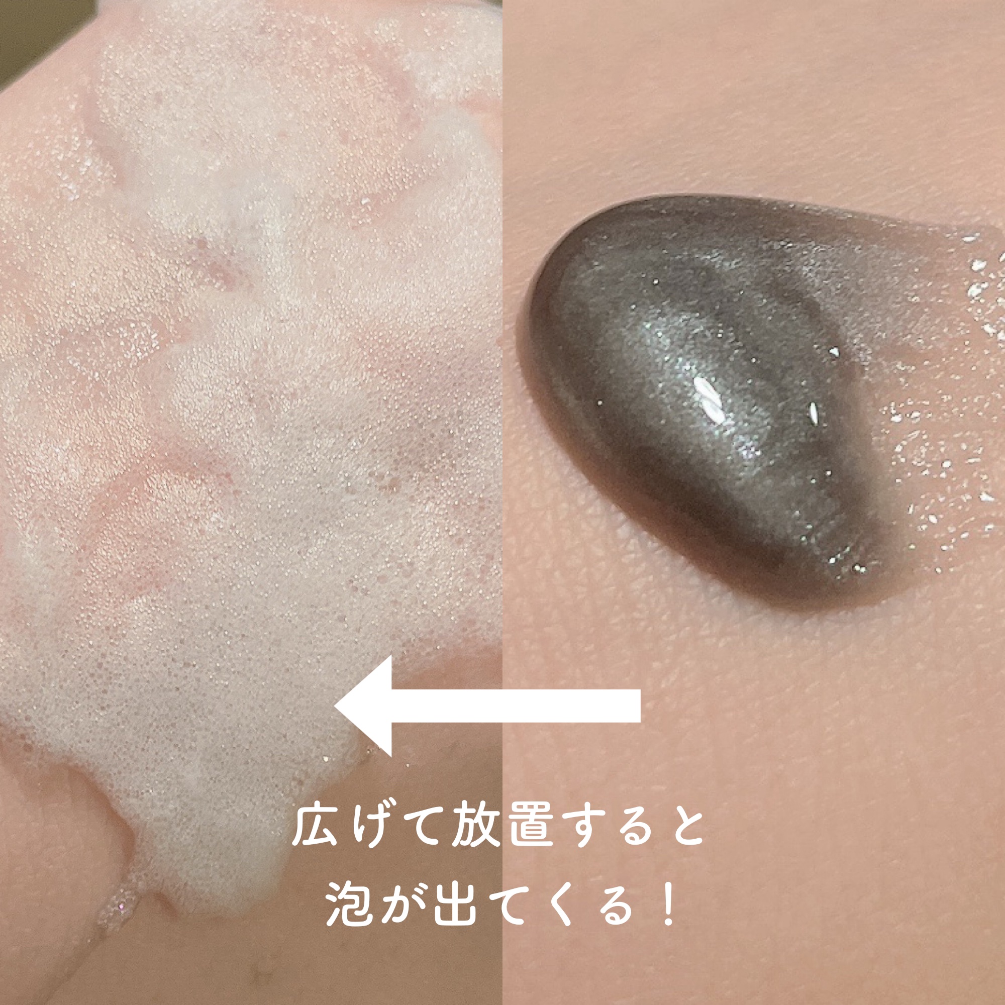 ジェムミラクル ブラックパール O2バブルマスク/the SAEM/洗い流すパック・マスクを使ったクチコミ（2枚目）