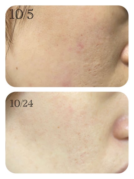 リンクルナイトクリーム/なめらか本舗/フェイスクリームを使ったクチコミ(4枚目)