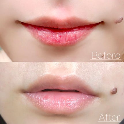 マジック オーガニックリップバーム/ドクターブロナー/リップバームを使ったクチコミ(5枚目)