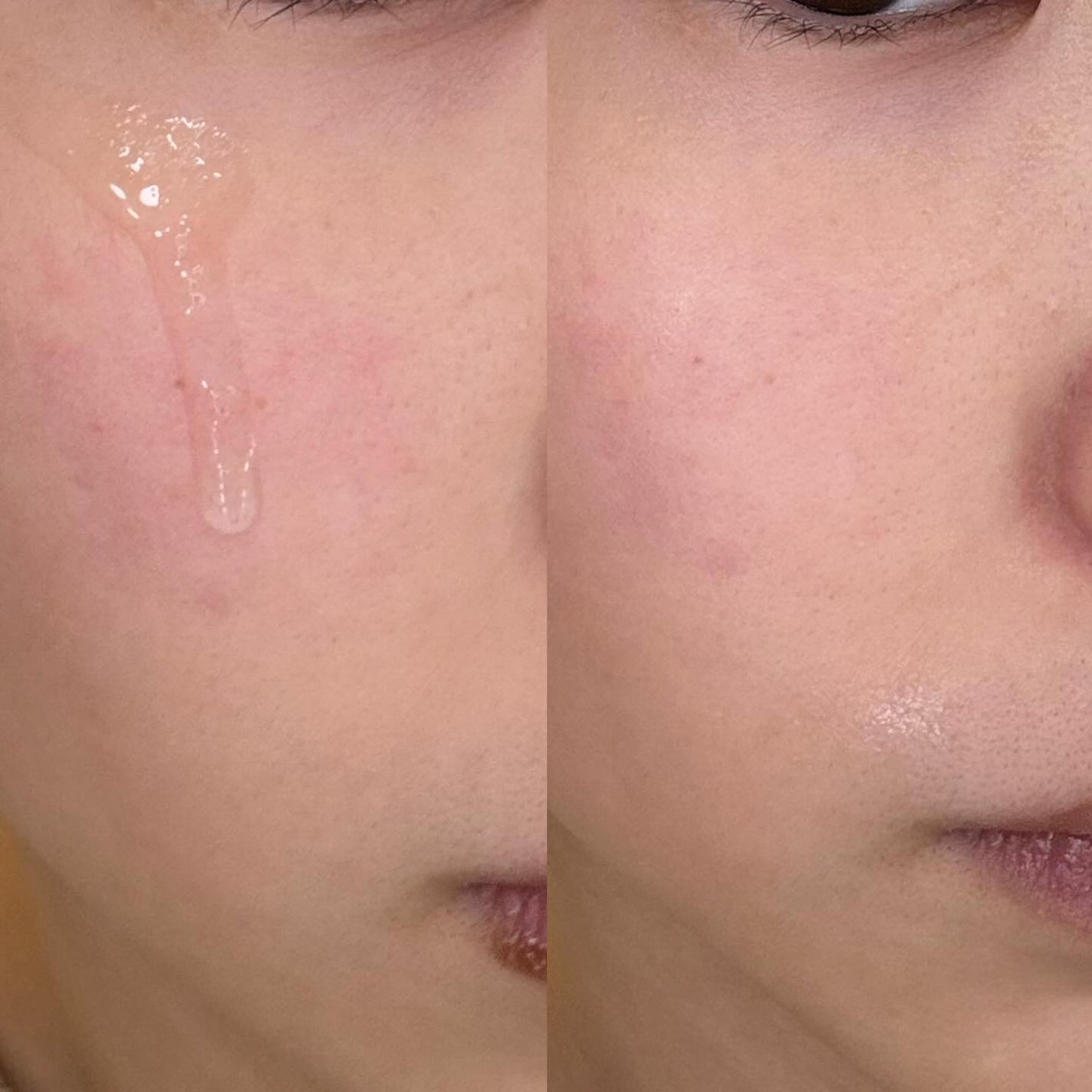 ガラクトポアセラム/SAM'U/美容液を使ったクチコミ(4枚目)