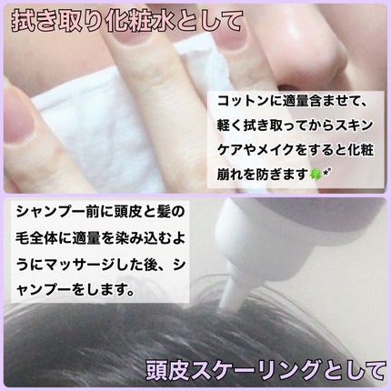 アクレオンセボエクストラクター/ANACIS/その他スキンケアを使ったクチコミ(4枚目)