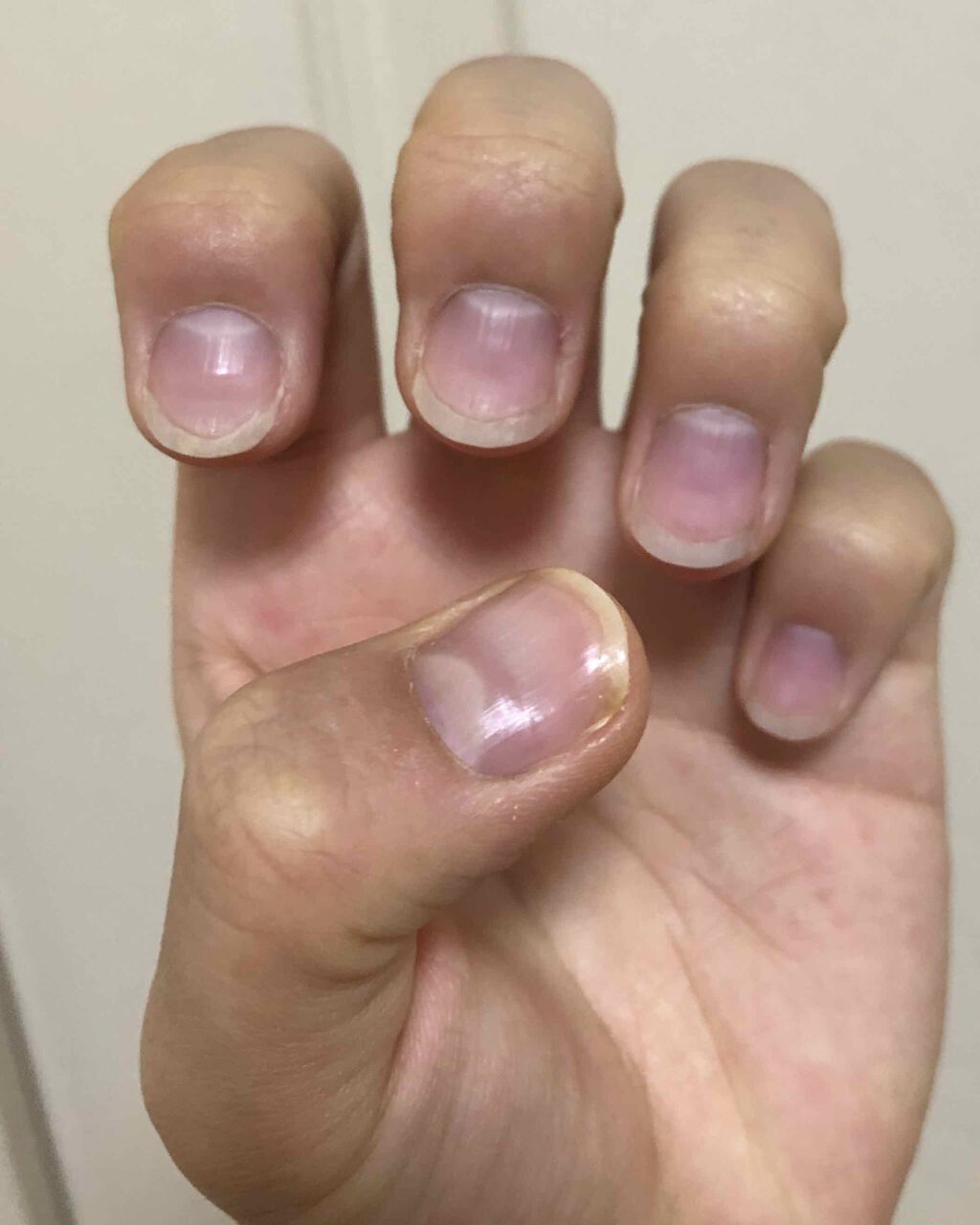 ネイルベッドオイル/アンドネイル/ネイルオイル・トリートメントを使ったクチコミ（1枚目）