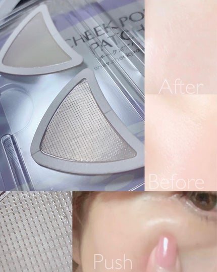 チークポアパッチ/北の快適工房/シートマスク・パックを使ったクチコミ(6枚目)