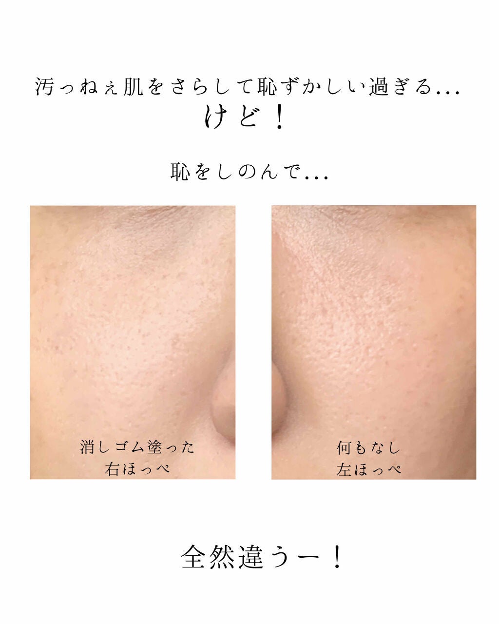 タンイドル ウルトラ ウェア ブラー /LANCOME/化粧下地を使ったクチコミ(2枚目)