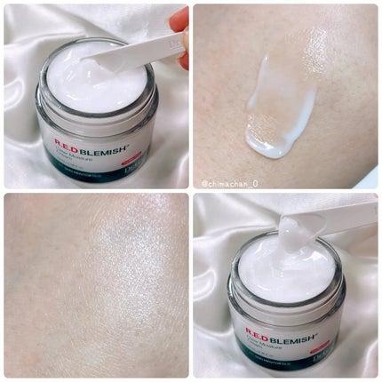 レッドブレミッシュ クリアモイスチャークリーム/Dr.G/フェイスクリームを使ったクチコミ(2枚目)