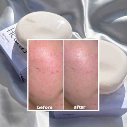 ブリージンググロークッション/Healus/クッションファンデーションを使ったクチコミ(3枚目)