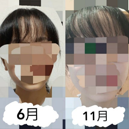 ハトムギ化粧水(ナチュリエ スキンコンディショナー R )/ナチュリエ/化粧水を使ったクチコミ(2枚目)