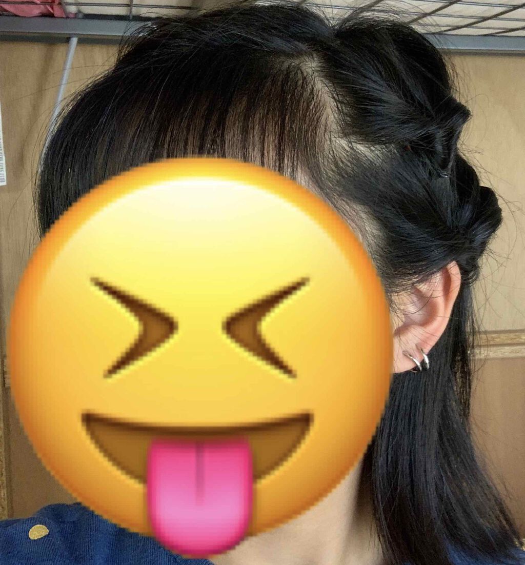 オシャレになりたい みー on LIPS 「初投稿ですけどよろしくお願いします! まず、1つ目は二重になる..」(3枚目)