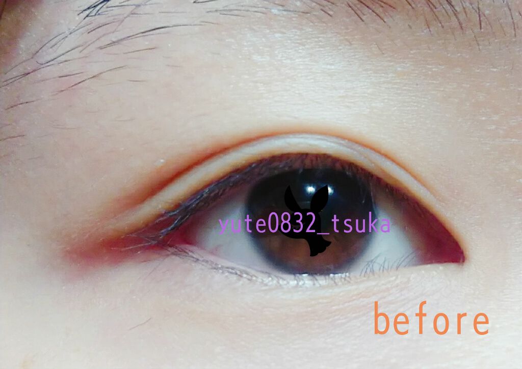 アイビューティー フィクサー WP/アストレア ヴィルゴ/二重まぶた用アイテムを使ったクチコミ（1枚目）