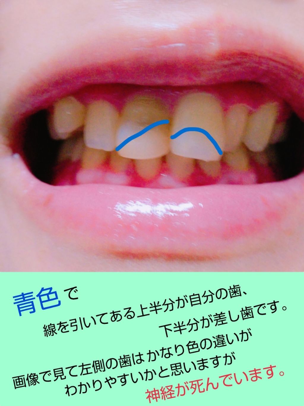 を使ったクチコミ（3枚目）