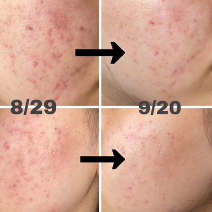 を使ったクチコミ(1枚目)