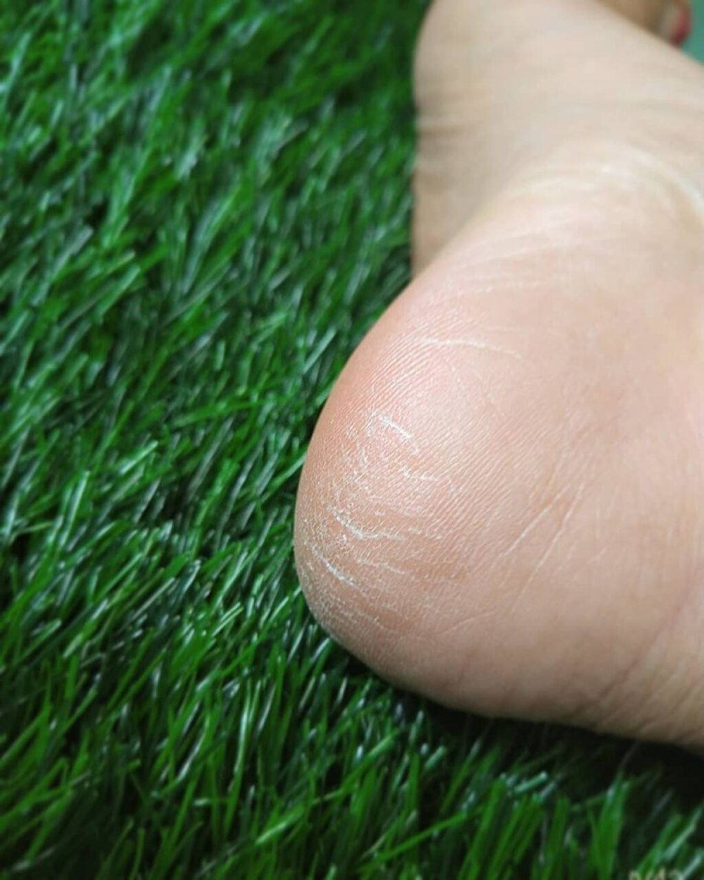 カカトリーヌモイストローション/KAKATOrine/レッグ・フットケアを使ったクチコミ(3枚目)