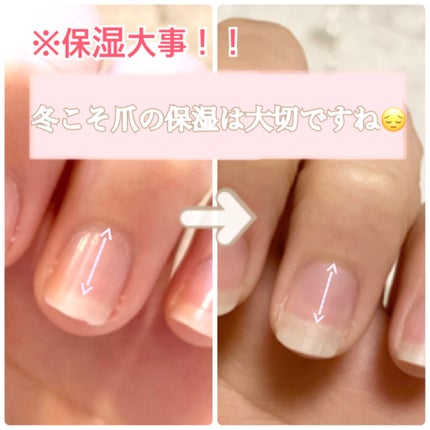 ネイルケアオイル/無印良品/ネイルオイル・トリートメントを使ったクチコミ(1枚目)