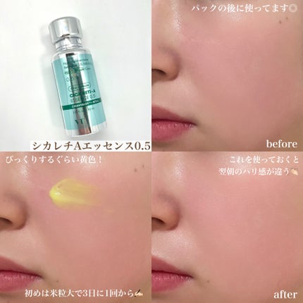 CICA デイリースージングマスク/VT/シートマスク・パックを使ったクチコミ(8枚目)