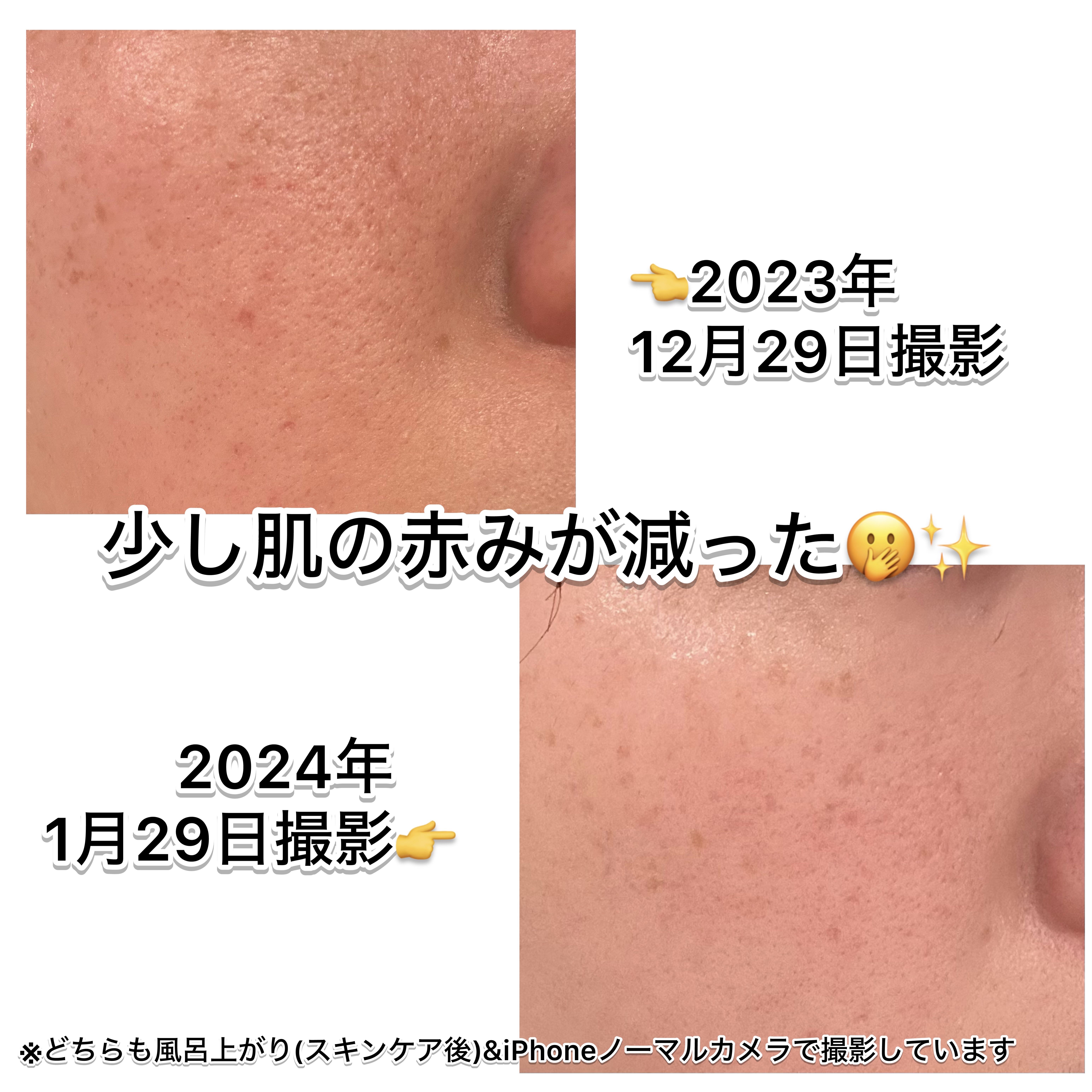 モイスト ローション/リッツ/化粧水を使ったクチコミ（3枚目）