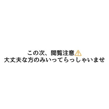 シュバまる on LIPS 「足裏シートの結果は！！【ゲルマニウム編】あと2つも、後々になり..」（3枚目）