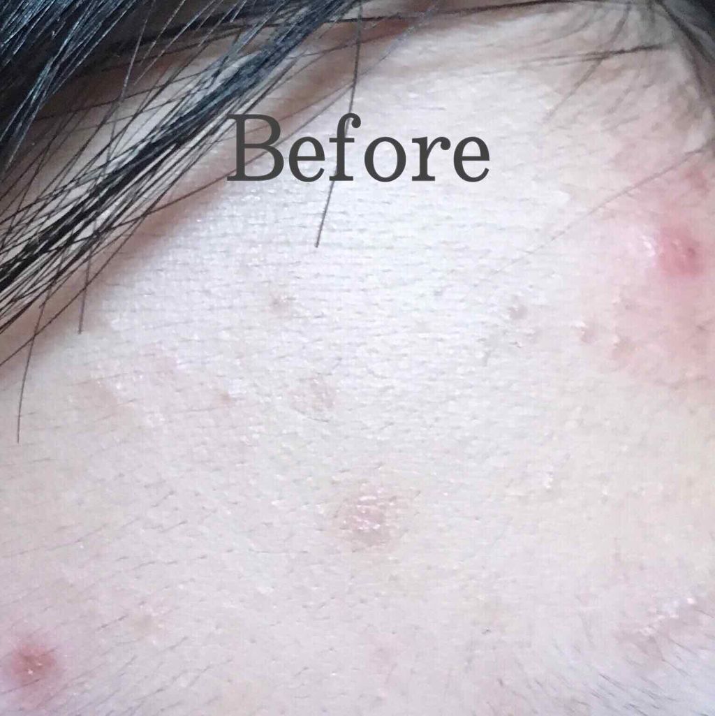 ボタニカル高保湿ジェル/NICE ＆ QUICK/美容液を使ったクチコミ（2枚目）