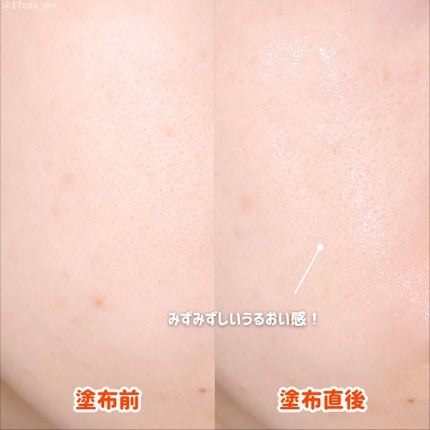 PDRNショット675/COSNORI/美容液を使ったクチコミ(4枚目)