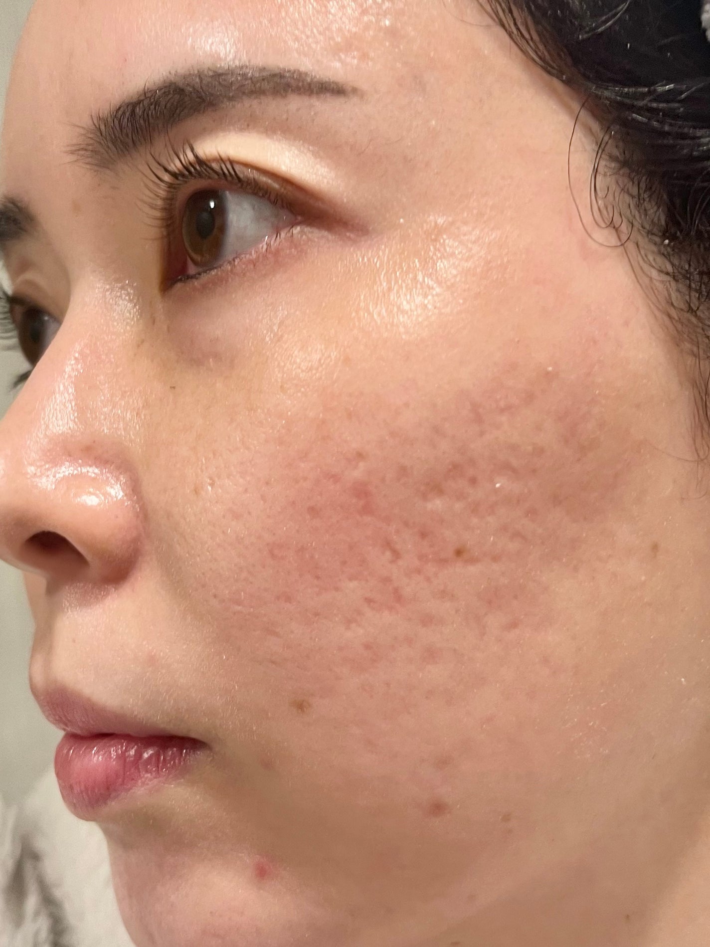 PDRNピンクアンプル PDRN 10,000ppm配合/MEDICUBE/美容液を使ったクチコミ(4枚目)