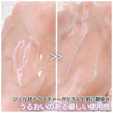 アカルミー化粧水/ワイズ/化粧水を使ったクチコミ(5枚目)