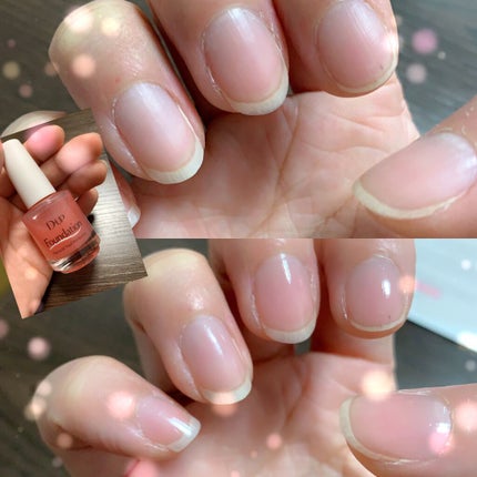 ディーアップファンデーション/D-UP/ネイルベースコートを使ったクチコミ(1枚目)