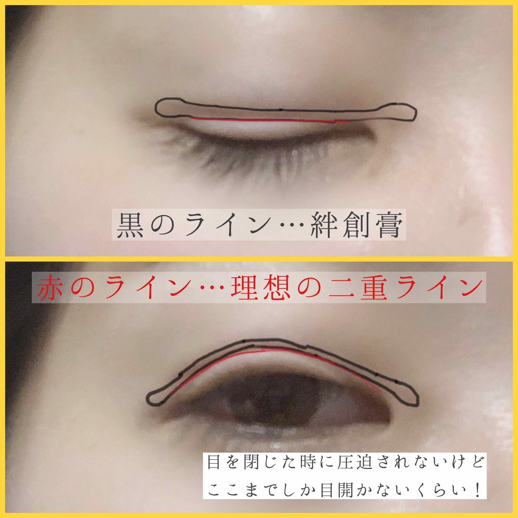 のびーるアイテープ(絆創膏タイプ、レギュラー)/DAISO/二重まぶた用アイテムを使ったクチコミ(4枚目)