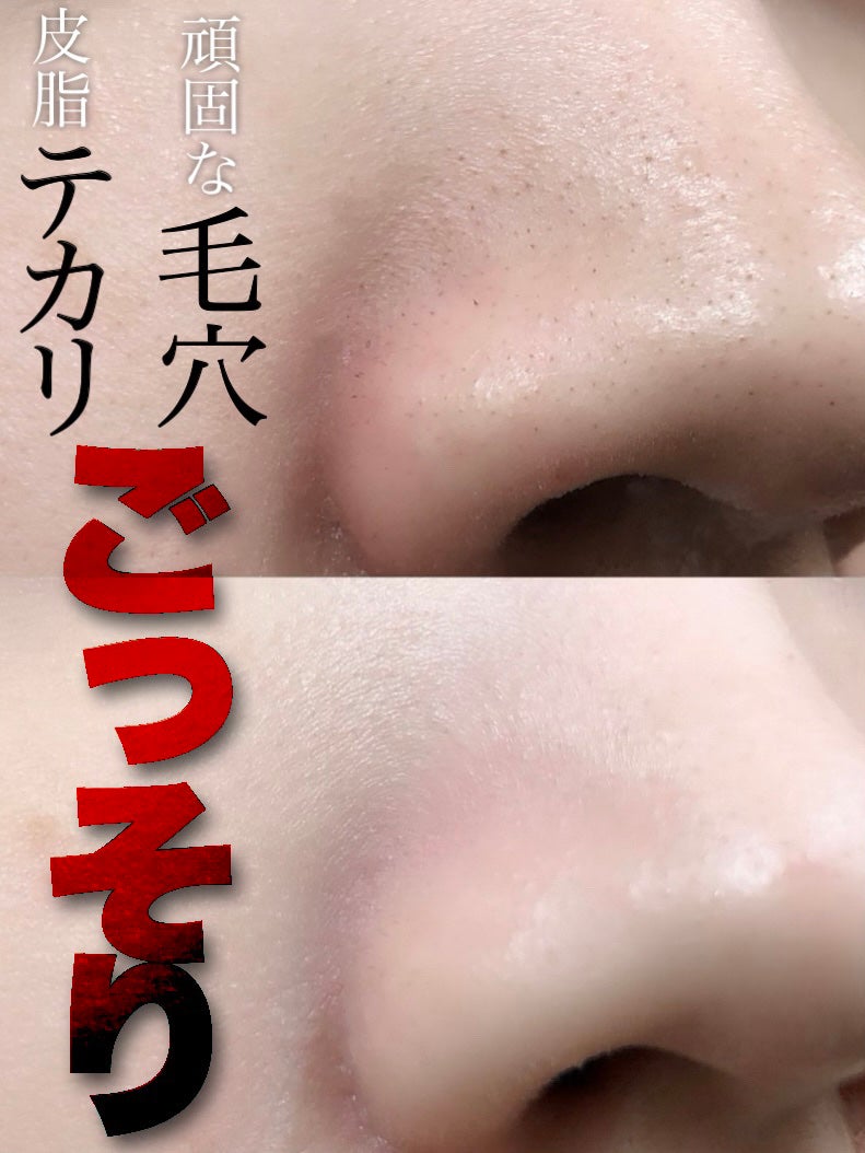 アンドハニー クレンジングバーム ブラック/&honey/クレンジングバームを使ったクチコミ(1枚目)