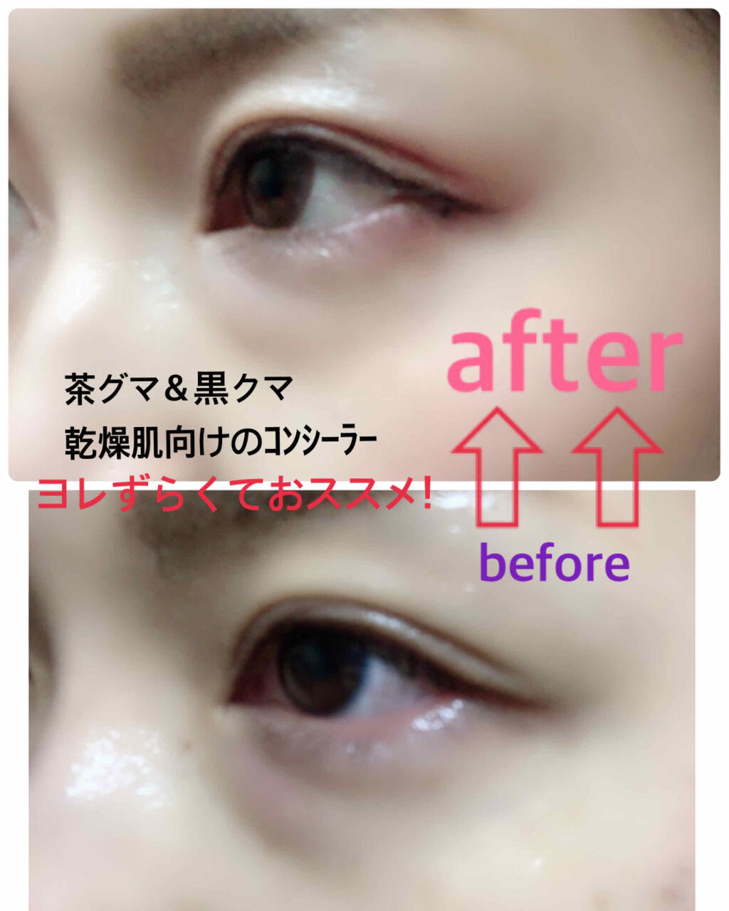 ザ タイムr デイエッセンススティック Ipsaを使った口コミ 黒クマと茶クマ コンシーラー 乾燥肌今ま By 乾燥肌 30代前半 Lips