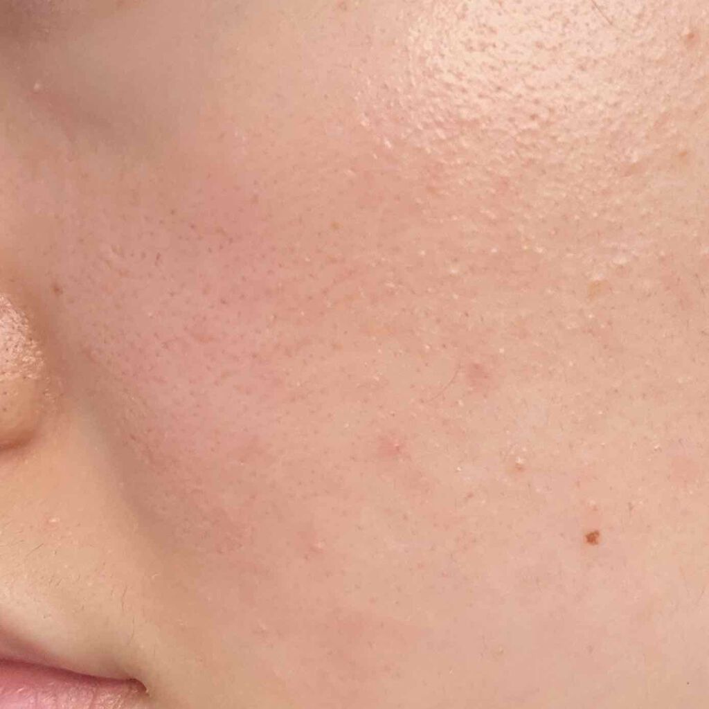 しっかりクリアジェル/ビオレ/クレンジングジェルを使ったクチコミ(4枚目)