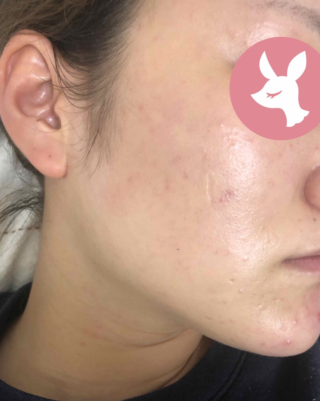 ビジャ ローション/innisfree/乳液を使ったクチコミ（2枚目）